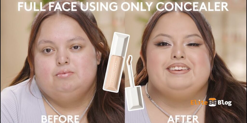 Health Condition: Bell’s Palsy Explained